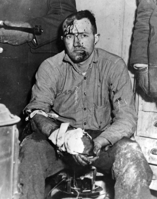 Heilman, recaptured after the 1947 escape from the State Penitentiary in Canon City, Colorado, has a rifle aimed at his blood spattered, half shaved head. His hand, wounded by gunshot, is wrapped in bloody rags; he sits holding it. The guard holding the gun wears mittens. A trash can and dresser flank the convict. Heilman was convicted of kidnapping Deputy District Attorney Fred Pferdesteller in Denver, 4/24/45.